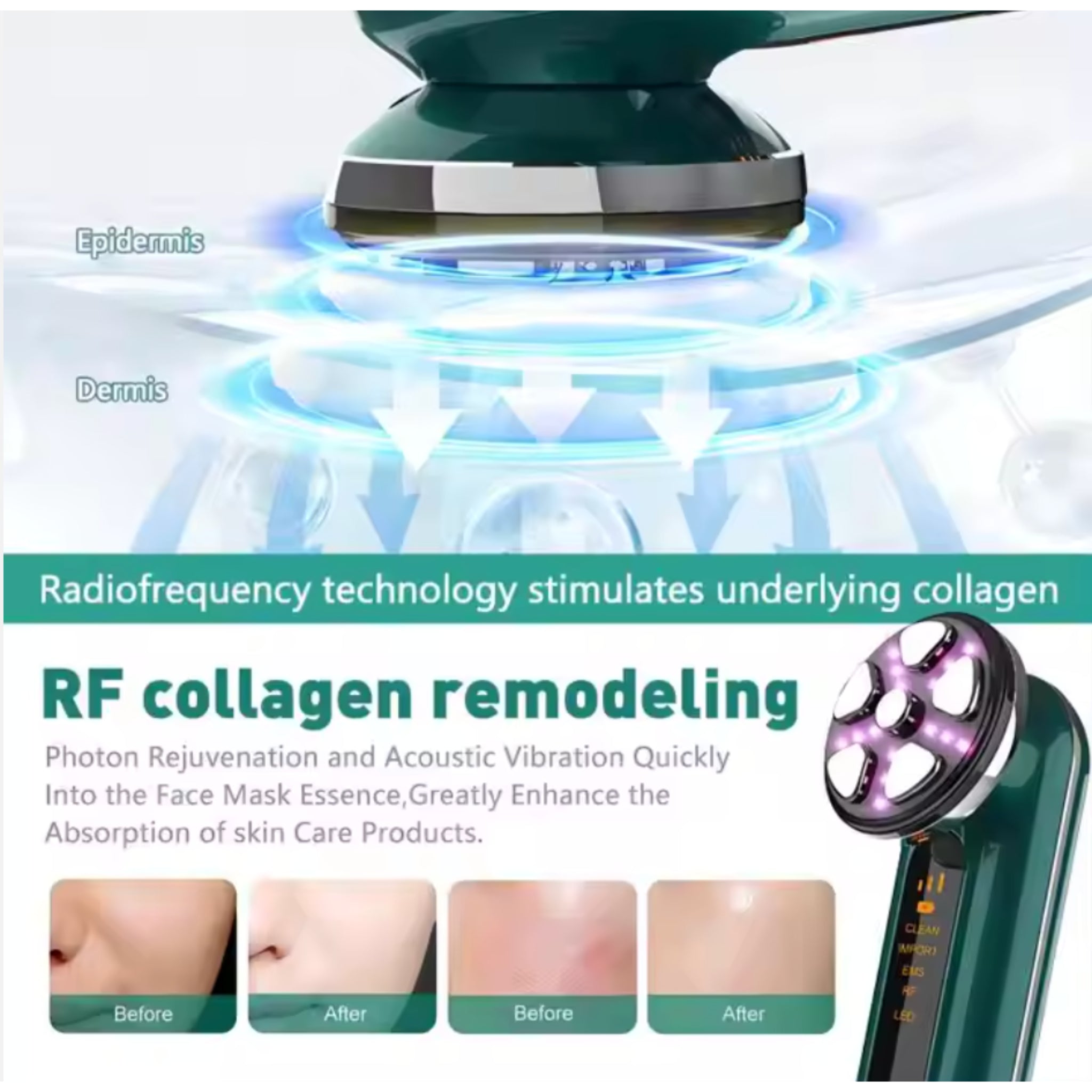 GlowLift High-Frequency Facial Massager